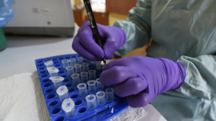 Nigeria Ebola case matches DR Congo strain
