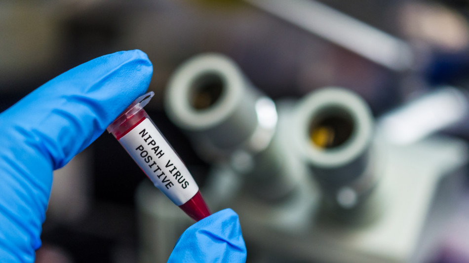 Ad aprile i primi test per un vaccino contro il virus Nipah